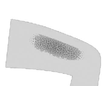 Skincare exams bruise icon<br />
