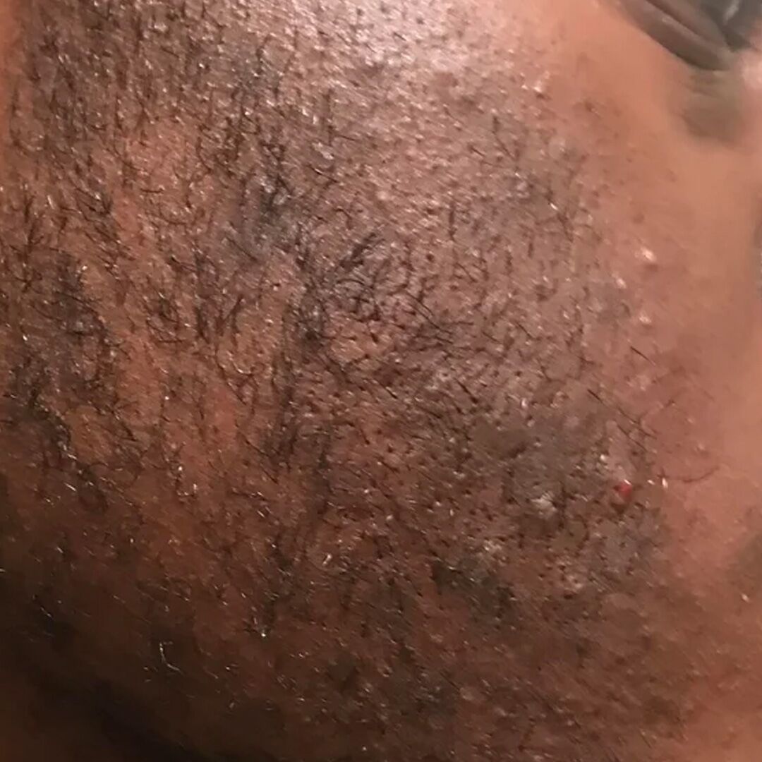 skincare-exams-case-10 Skincare exams case 10