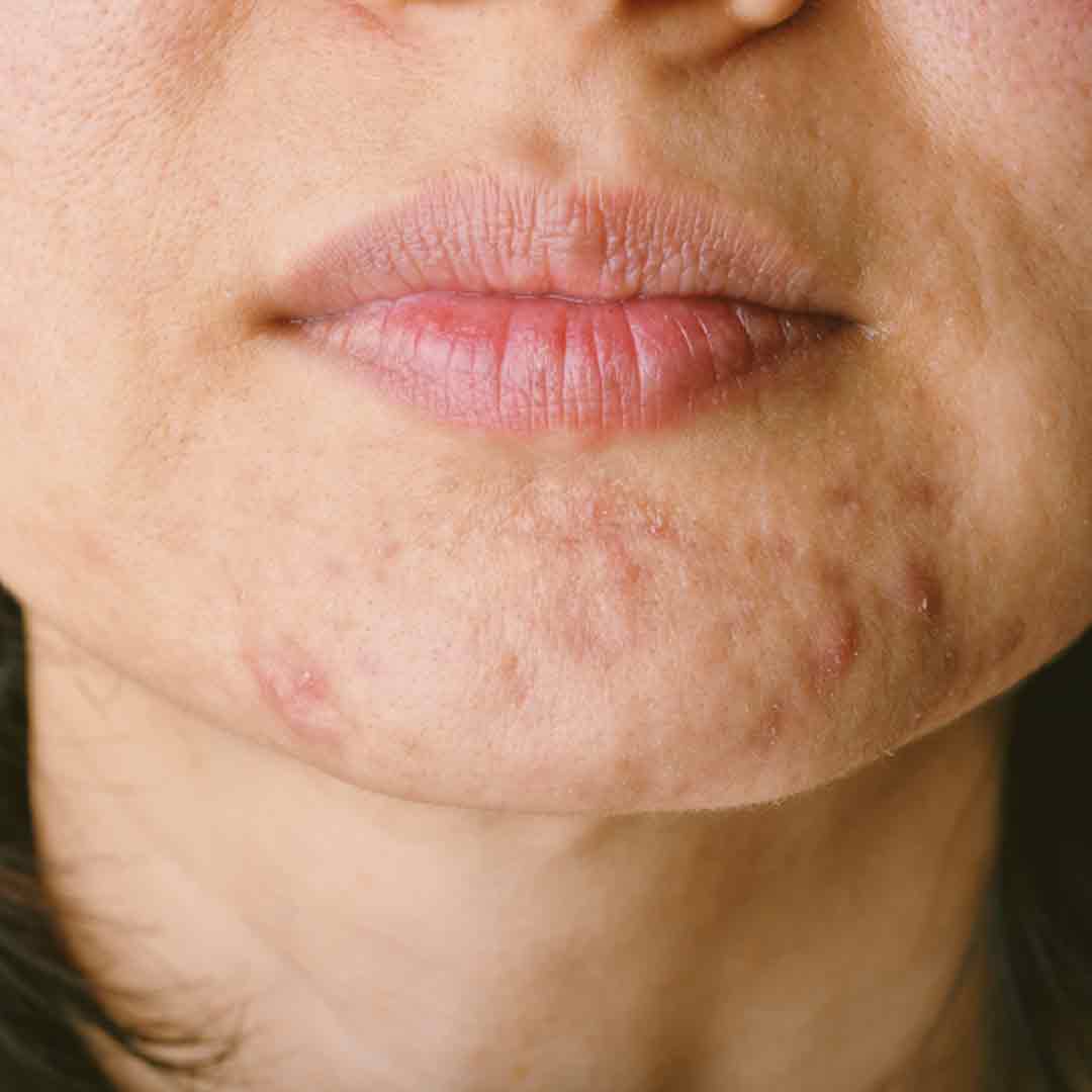 skincare-exams-case-102-1 Skincare Exams 102