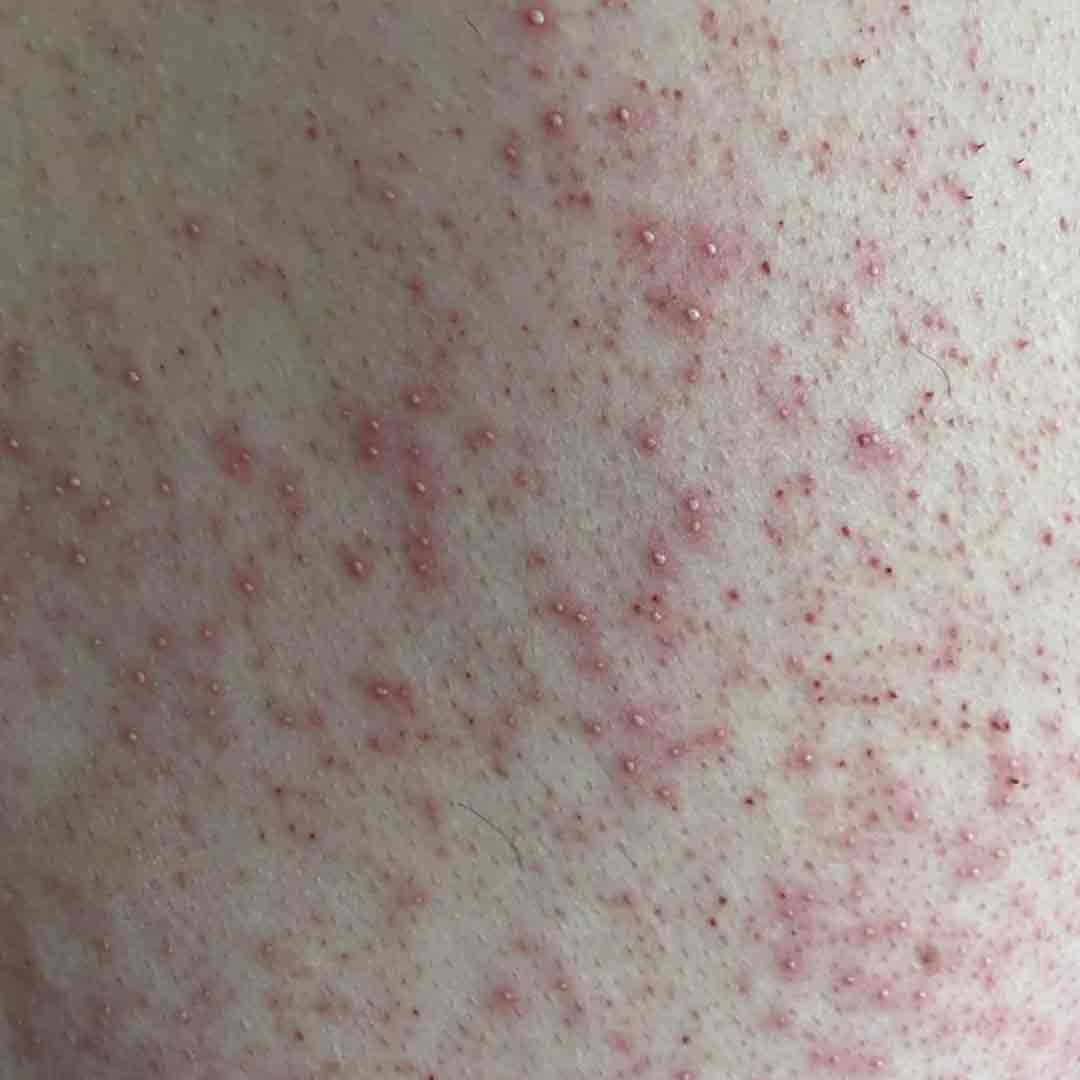 skincare-exams-case-104 Skincare case 104