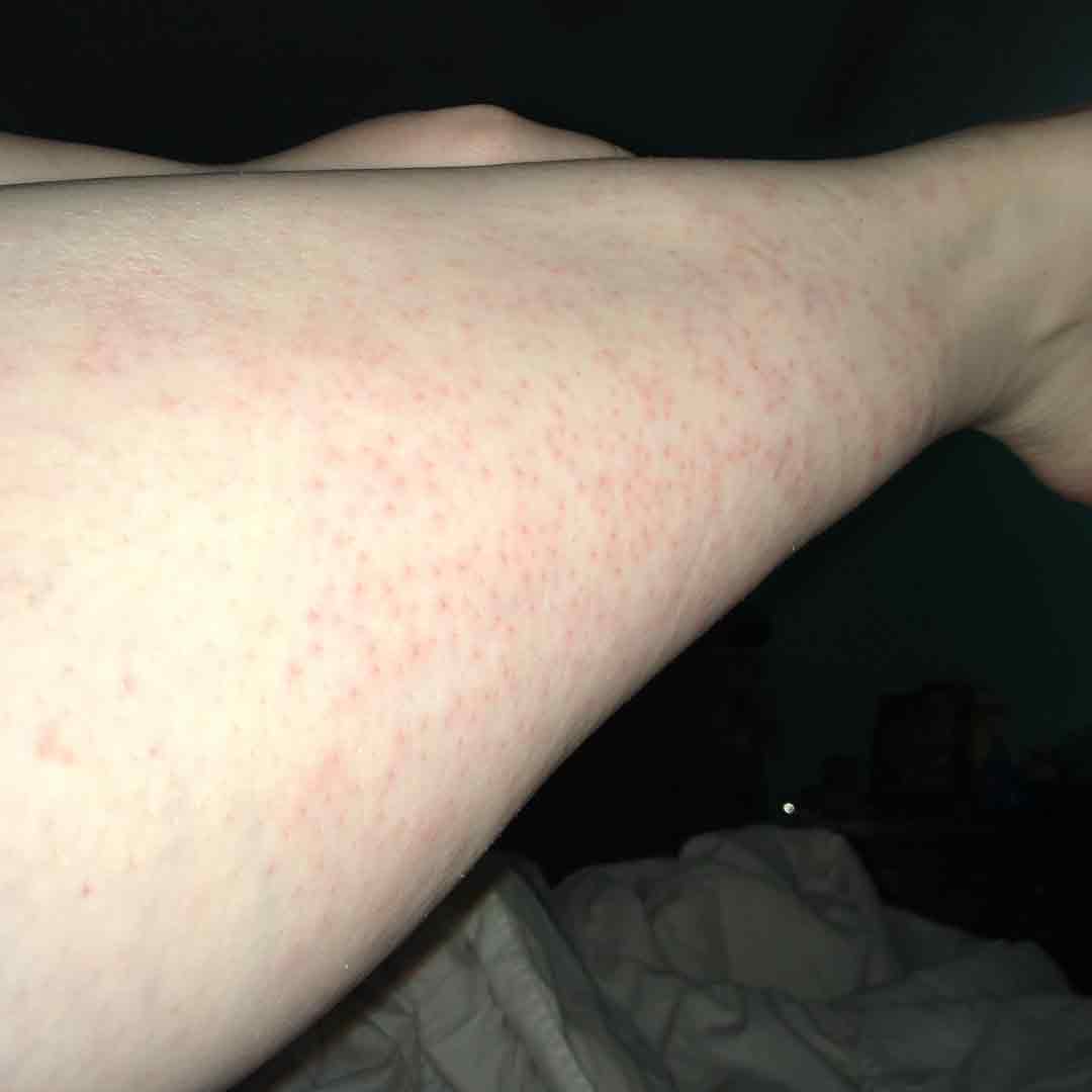 skincare-exams-case-106 Skincare Case 106