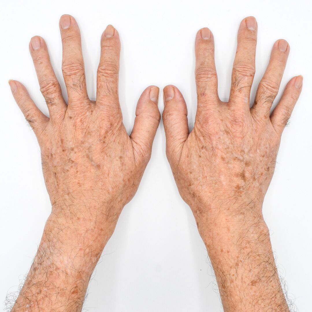 skincare-exams-case-113 Skincare Exams case 113