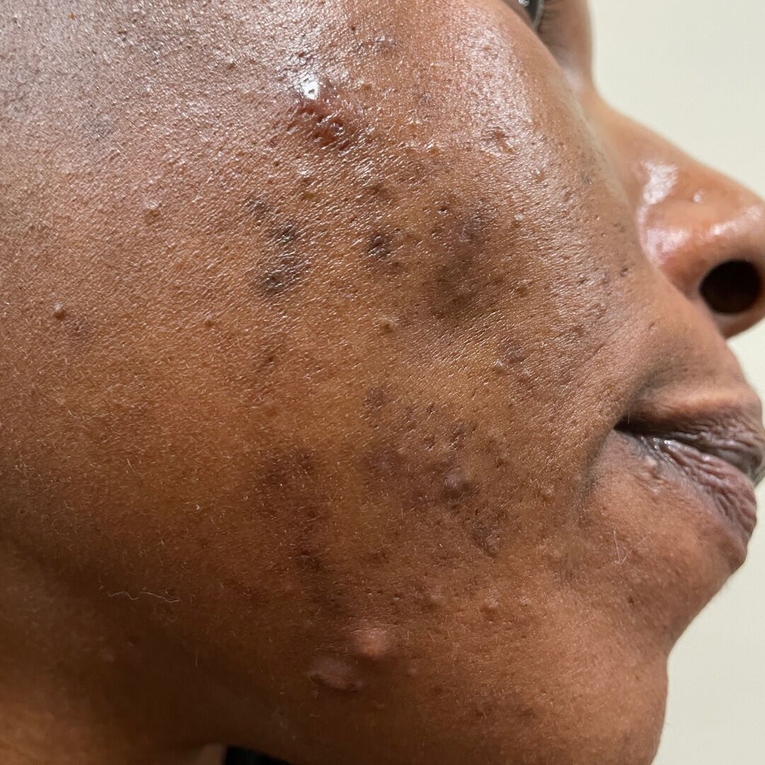 skincare-exams-case-117-1 Skincare Exams Case 117-1