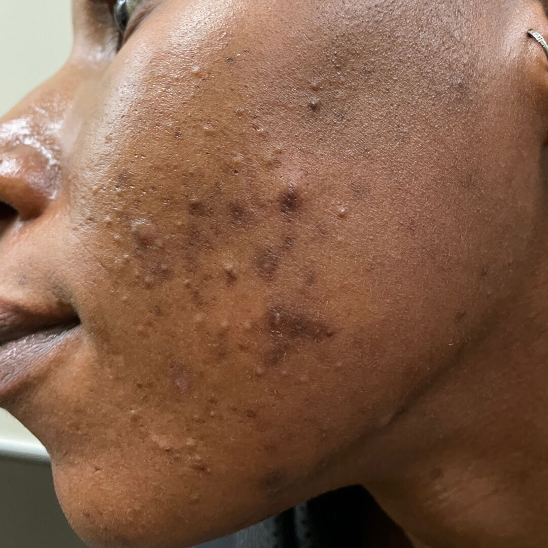 skincare-exams-case-117-2 Skincare Exams Case 117-2