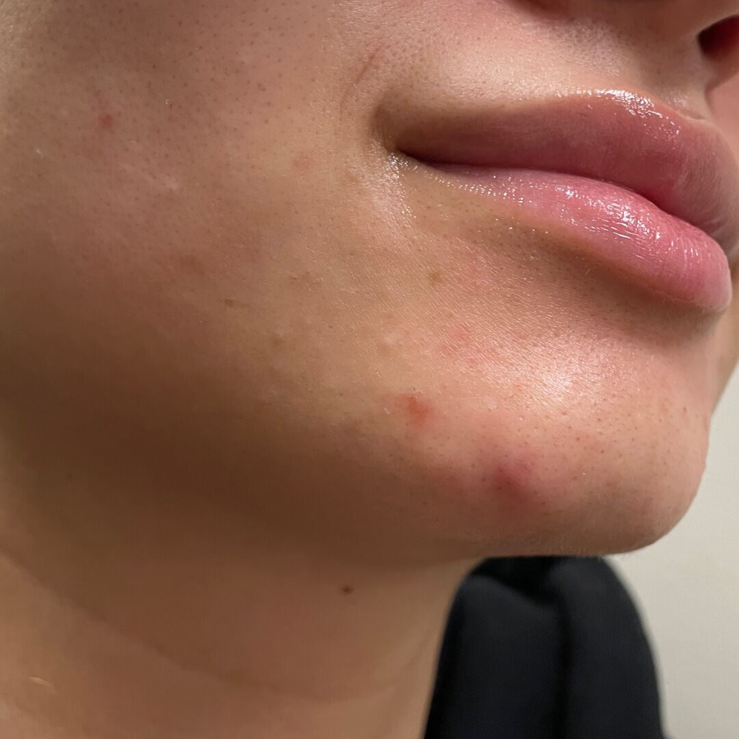 skincare-exams-case-118 Skincare Exams Case 118