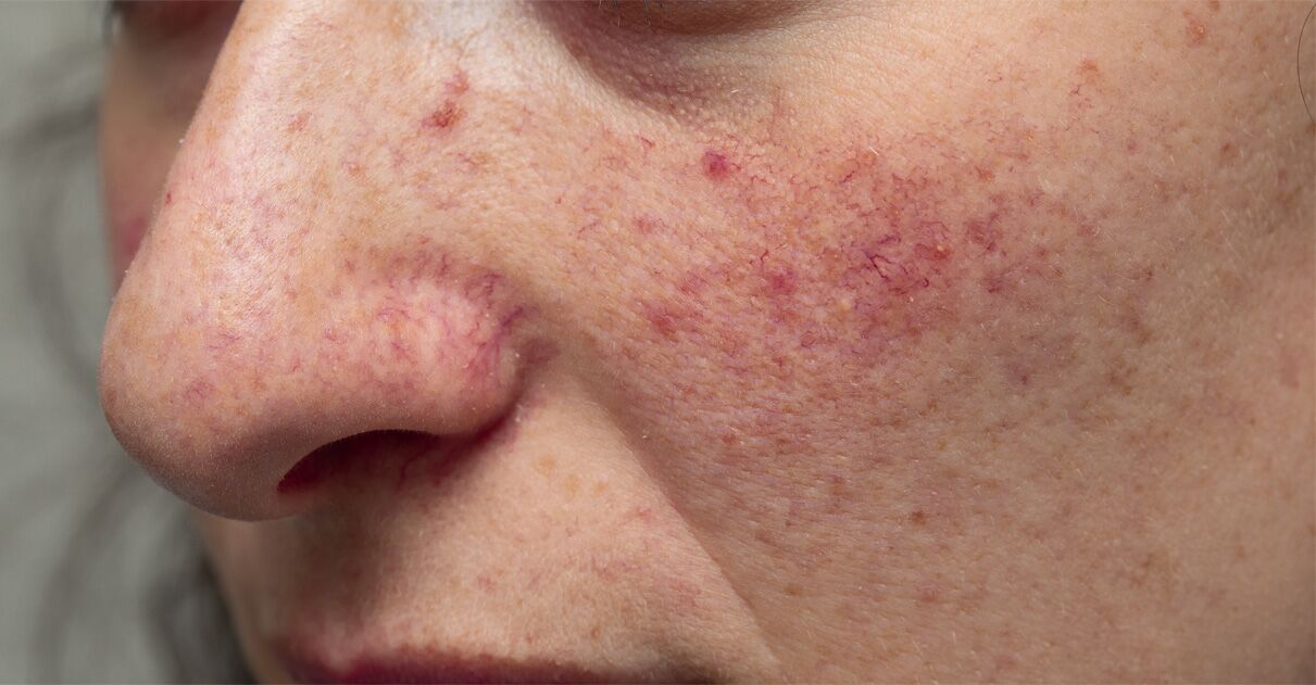 skincare-exams-case-124 Skincare Exams Case 124