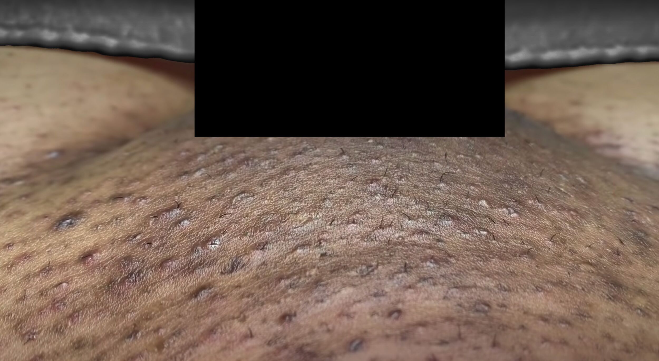 skincare-exams-case-127-1 Skincare Exams Case 127