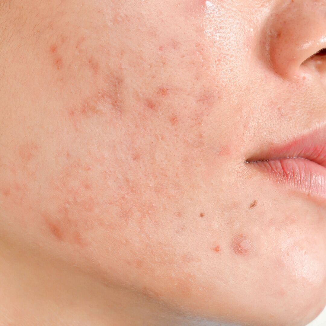 skincare-exams-case-8 Skincare case 8