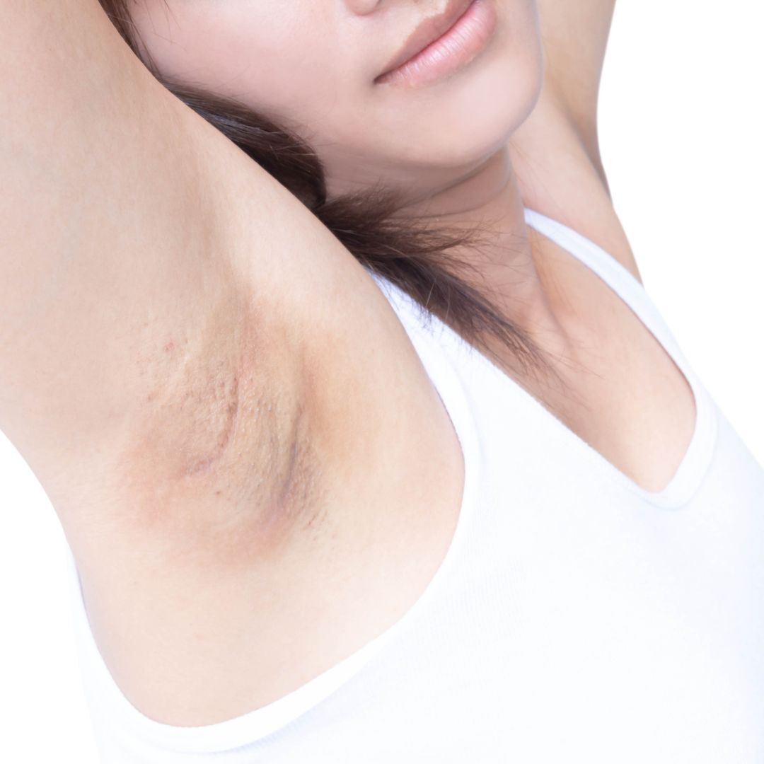 skincare-exams-case-131 Skincare exams case 131